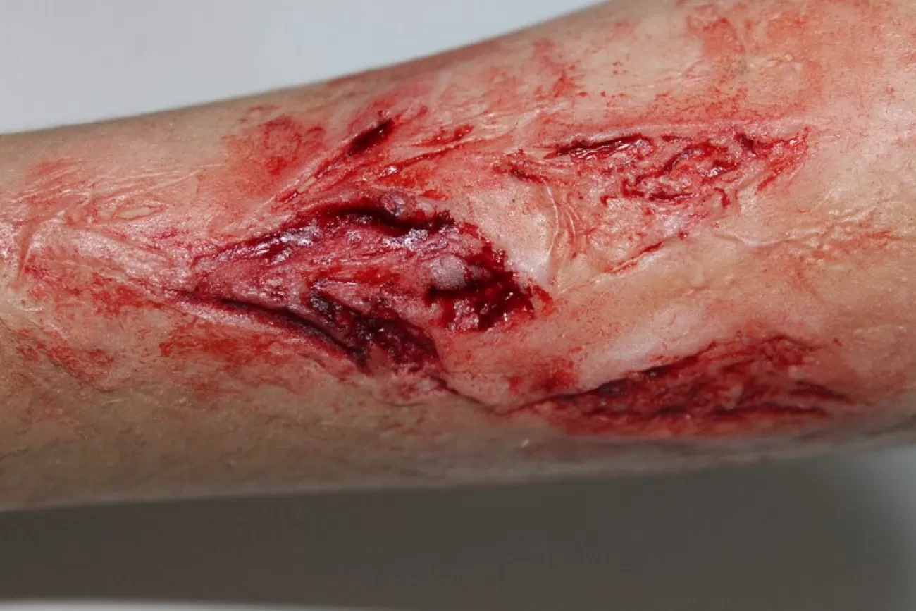 ForensicFX Studios Arm Lacerations/Cuts Prosthetic> Halloween Accessories