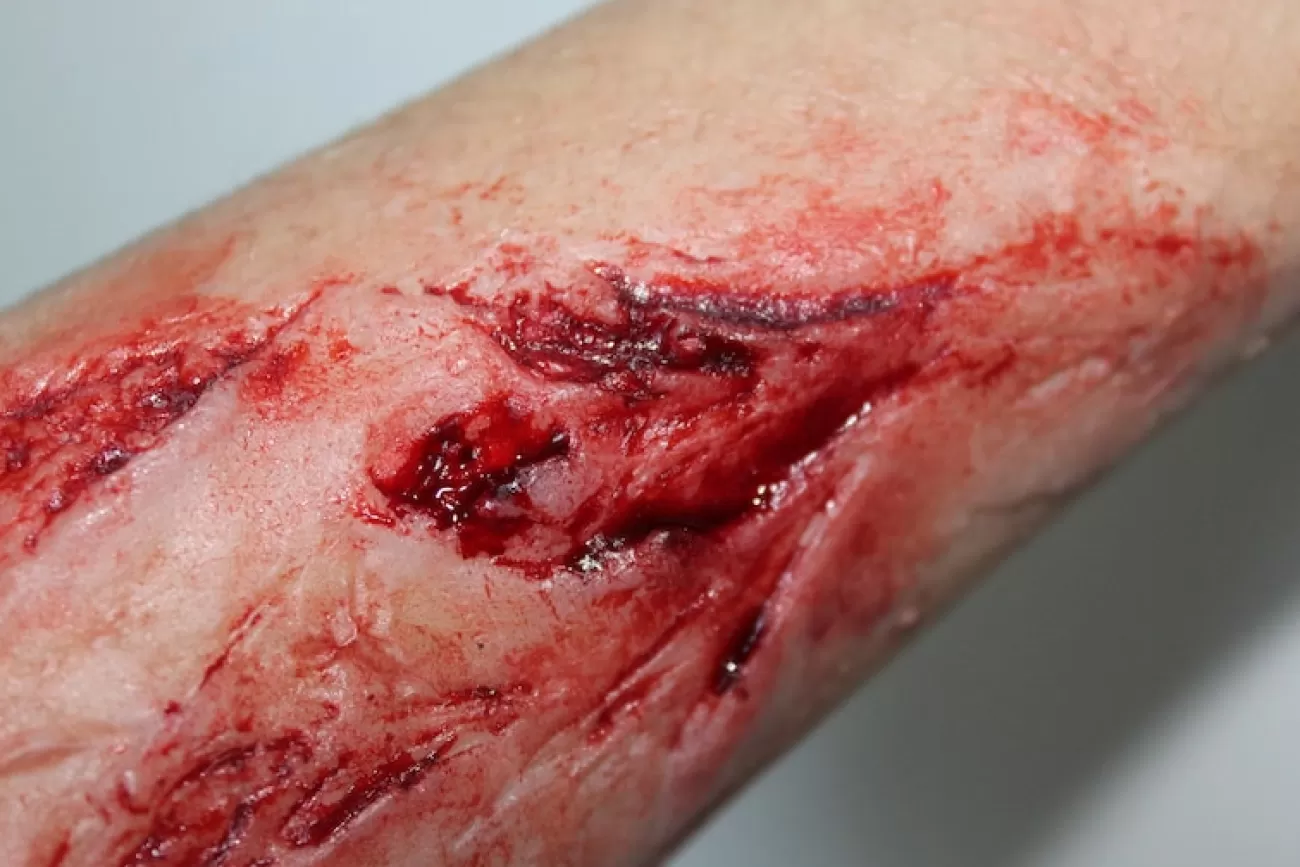 ForensicFX Studios Arm Lacerations/Cuts Prosthetic> Halloween Accessories