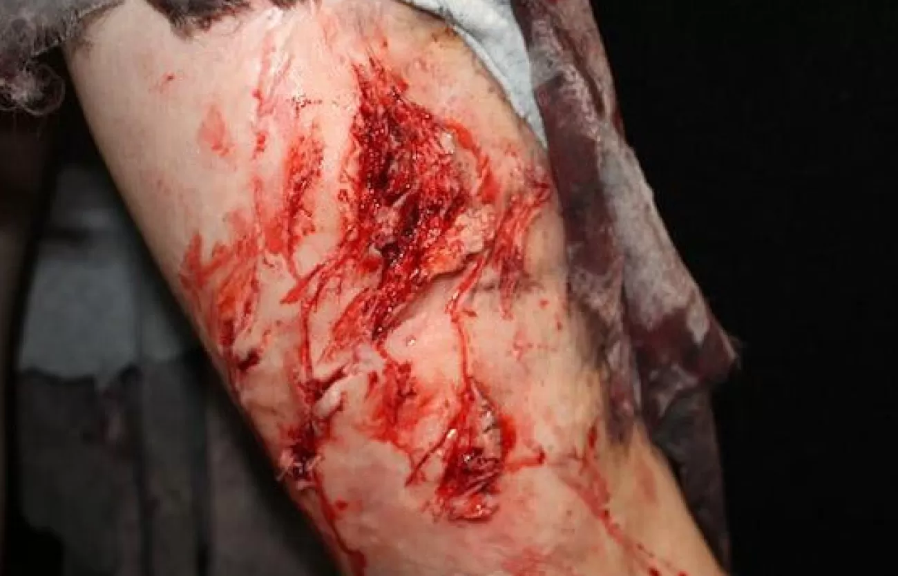 ForensicFX Studios Deep Leg Lacerations Prosthetic> Halloween Accessories