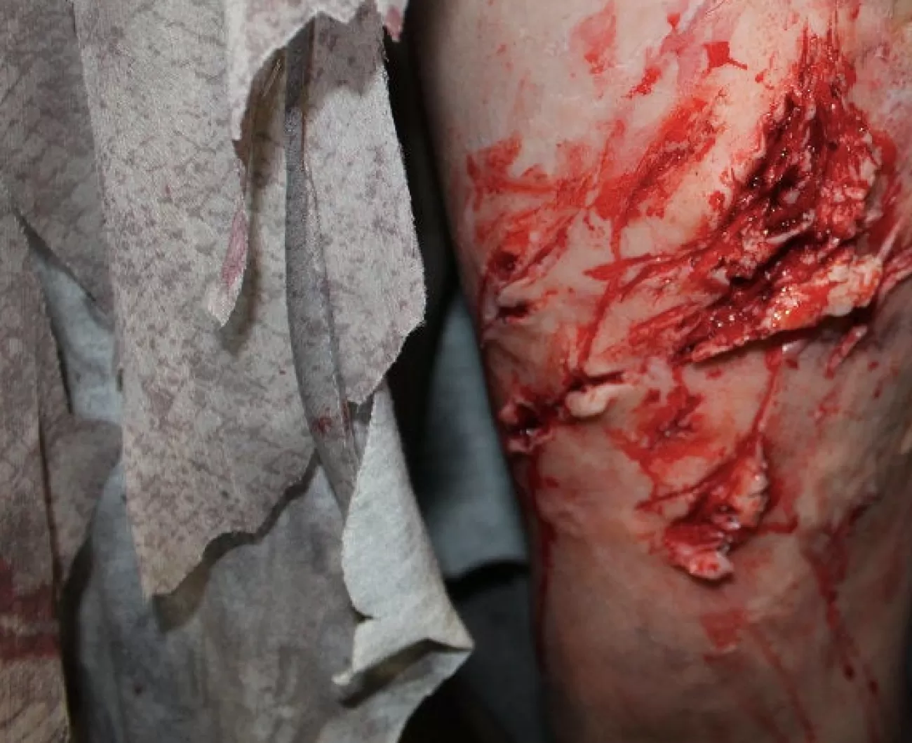 ForensicFX Studios Deep Leg Lacerations Prosthetic> Halloween Accessories