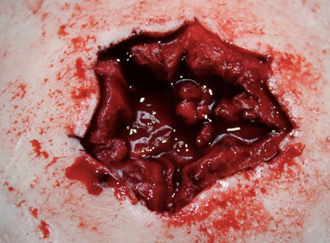 ForensicFX Studios Entry & Exit Bullet Wound Prosthetic> Halloween Accessories