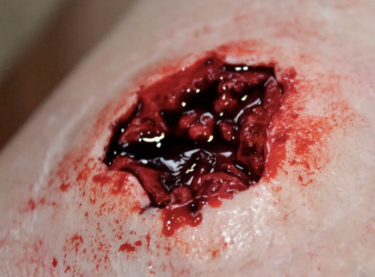 ForensicFX Studios Entry & Exit Bullet Wound Prosthetic> Halloween Accessories