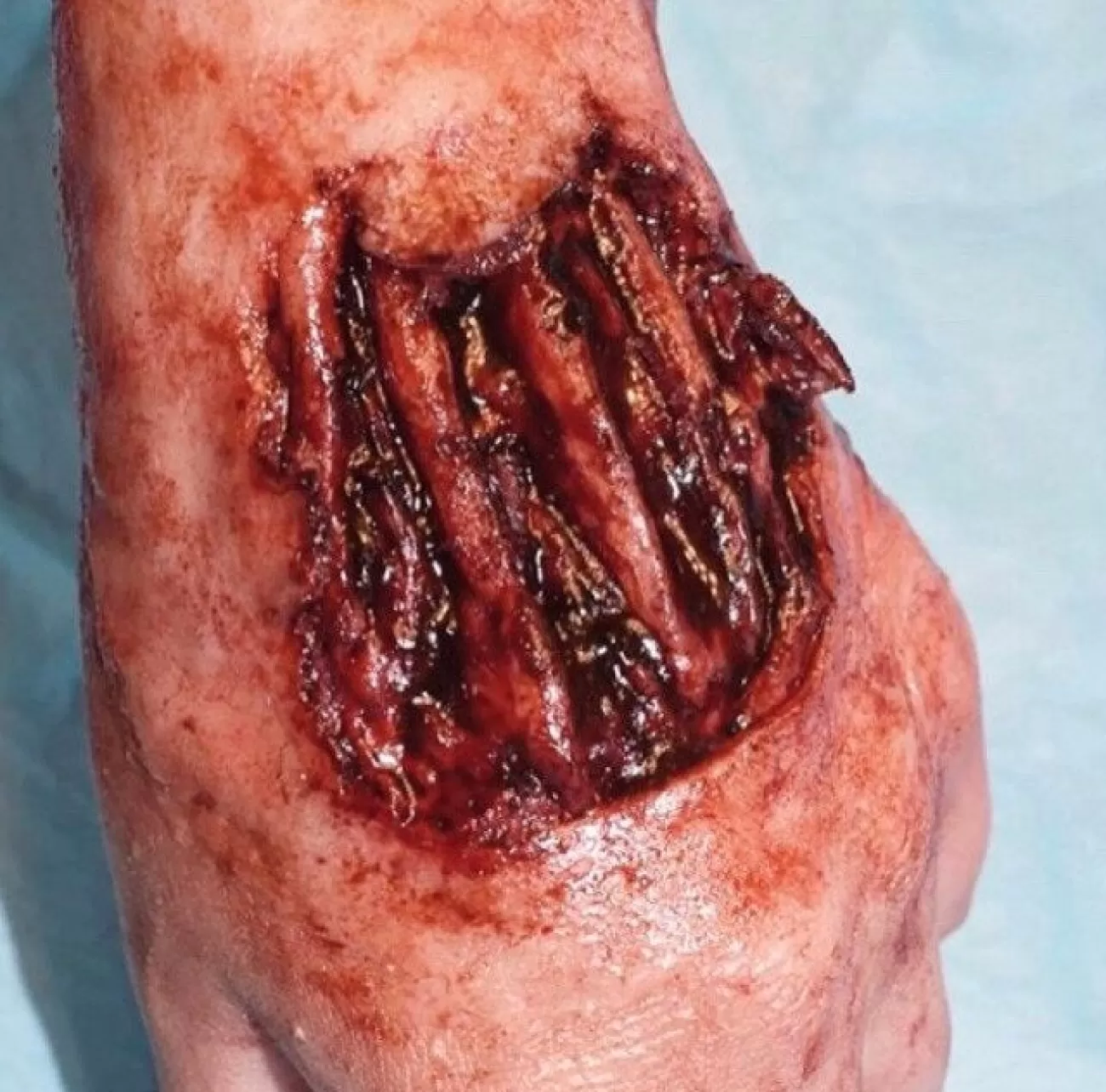 ForensicFX Studios Exposed Hand Ligaments Prosthetic> Halloween Accessories