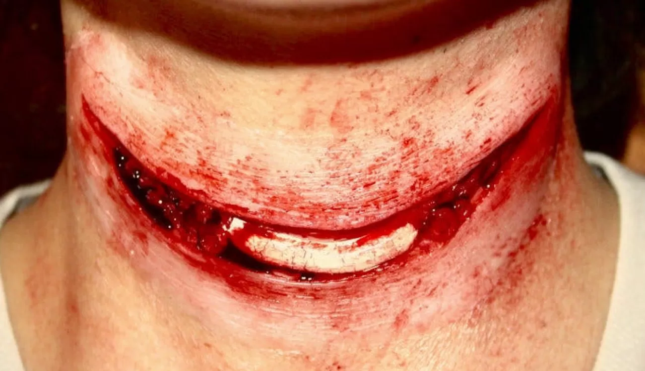 ForensicFX Studios Exposed Slit Throat Prosthetic> Halloween Accessories