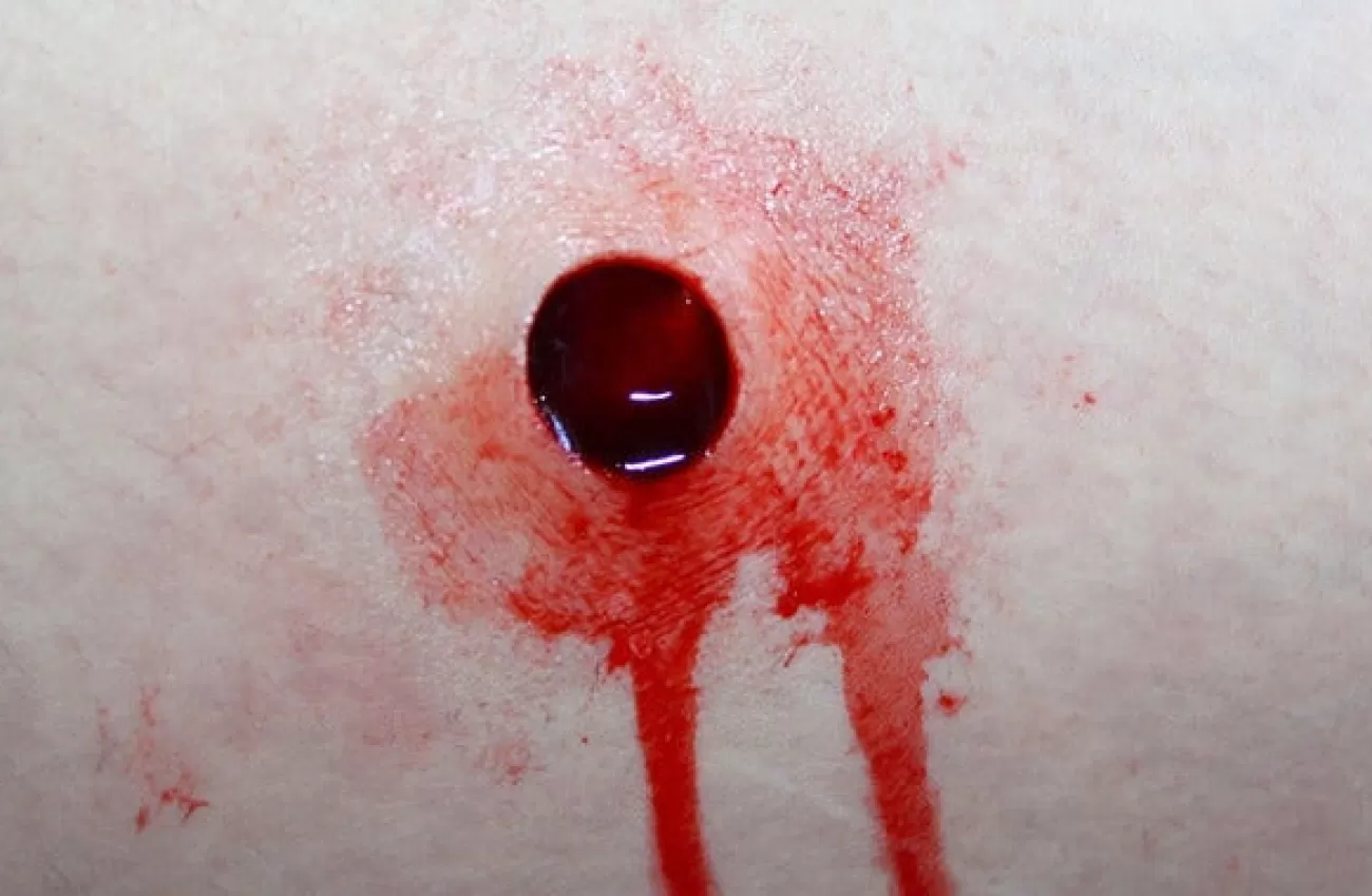 ForensicFX Studios Gunshot Entry Bullet Wound Prosthetic> Halloween Accessories