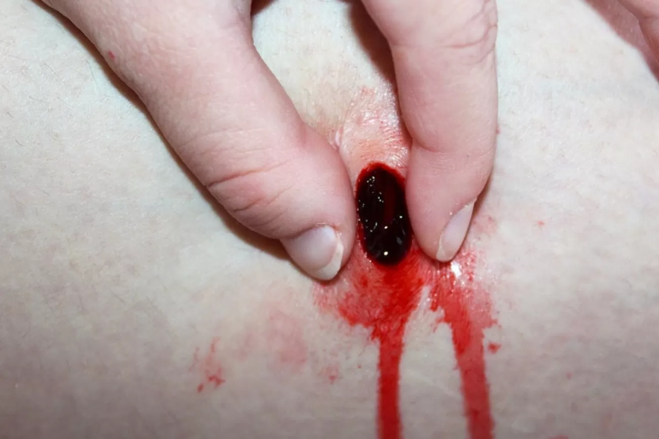 ForensicFX Studios Gunshot Entry Bullet Wound Prosthetic> Halloween Accessories