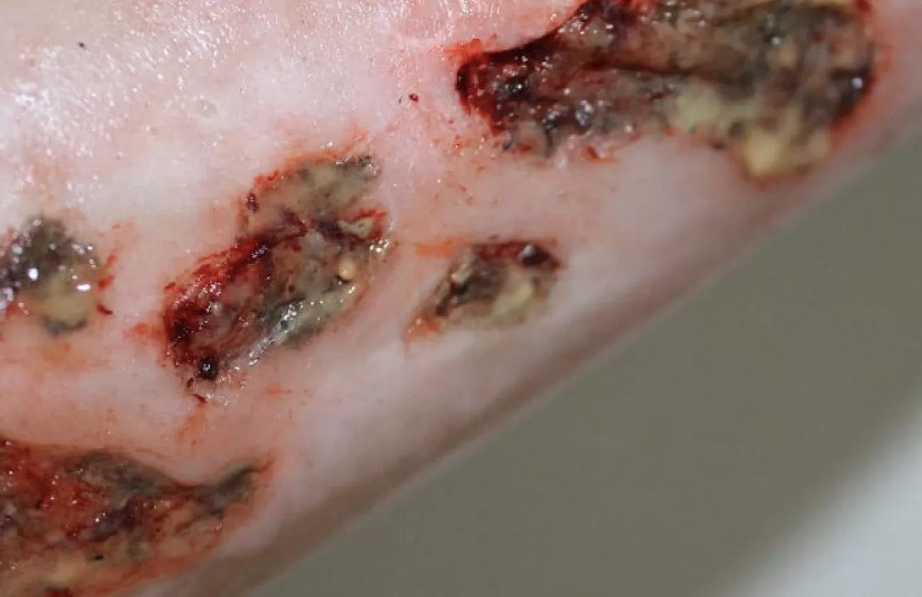 ForensicFX Studios Infected Wound / Burn Prosthetic> Halloween Accessories