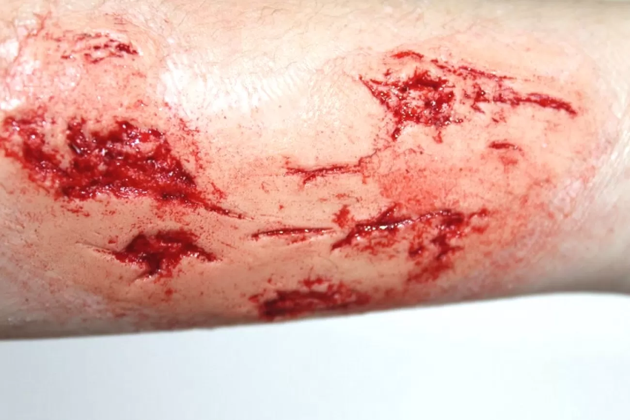 ForensicFX Studios Irregular Wound Lacerations Prosthetic> Halloween Accessories