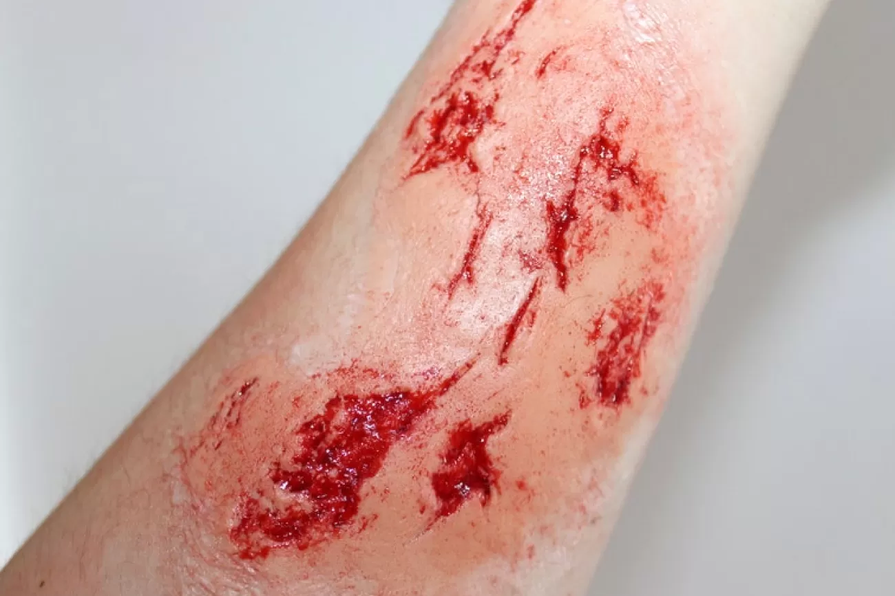 ForensicFX Studios Irregular Wound Lacerations Prosthetic> Halloween Accessories