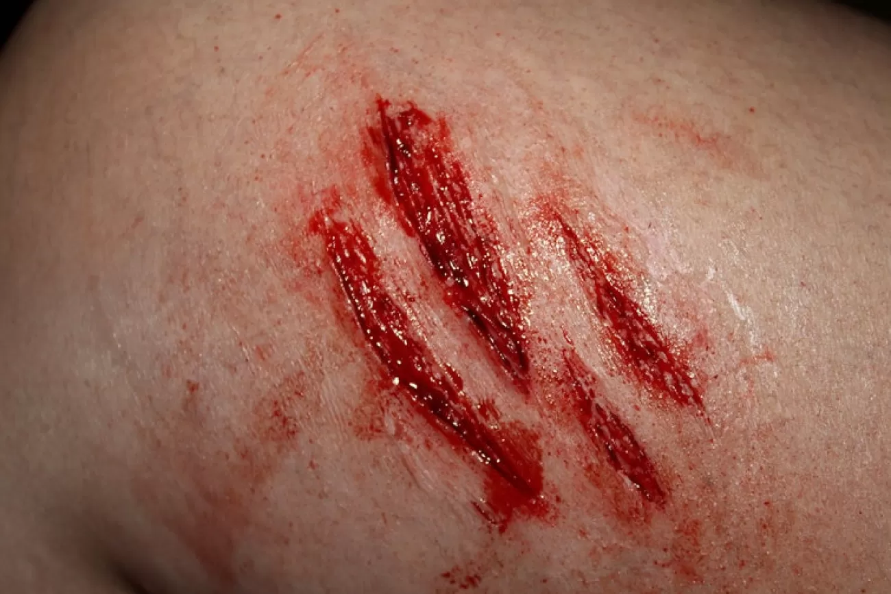 ForensicFX Studios Medium Scratch Mark Wounds Prosthetic> Halloween Accessories