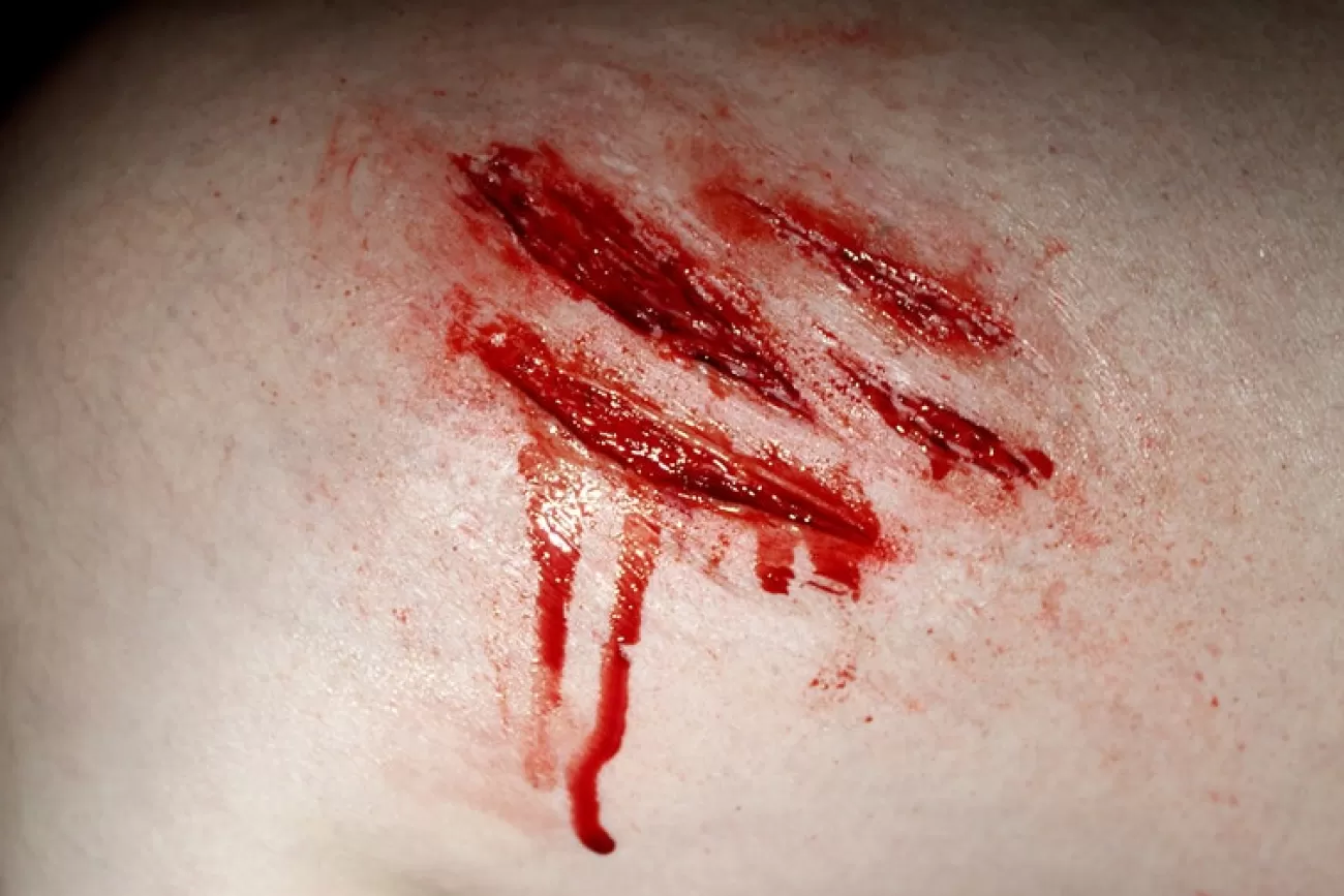 ForensicFX Studios Medium Scratch Mark Wounds Prosthetic> Halloween Accessories