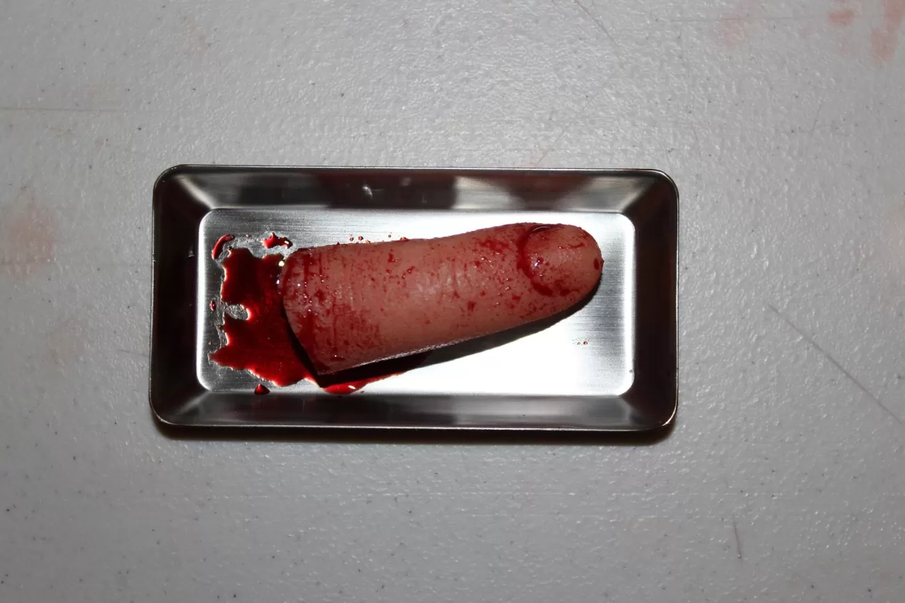 ForensicFX Studios Severed Finger Prop On Medical Metal Tray> Halloween Accessories