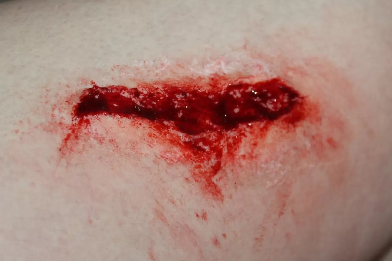 ForensicFX Studios Simple Wound Prosthetic> Halloween Accessories