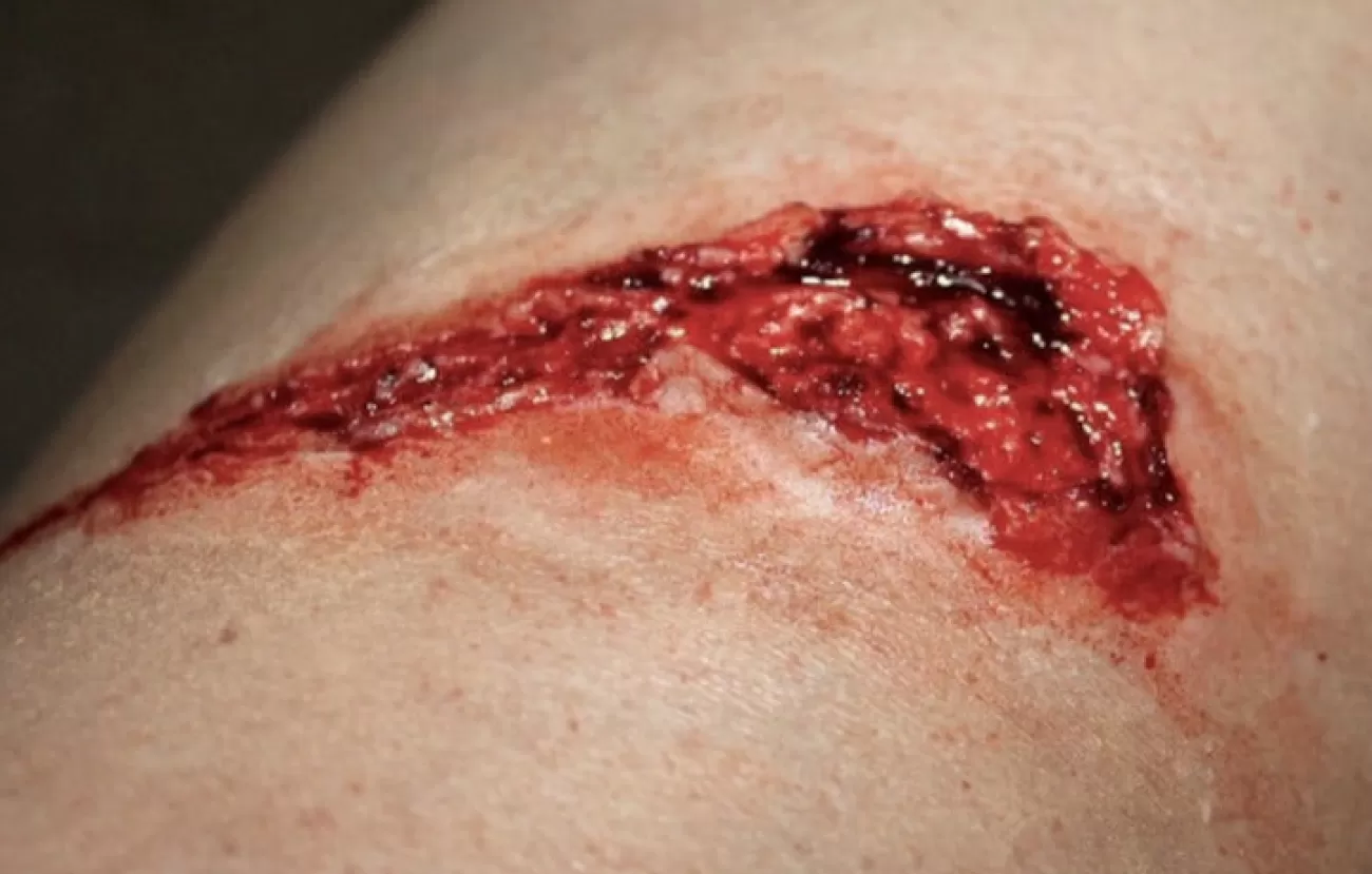 ForensicFX Studios Small Thigh Laceration Prosthetic> Halloween Accessories