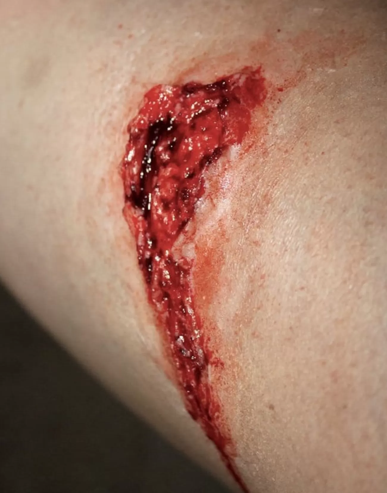 ForensicFX Studios Small Thigh Laceration Prosthetic> Halloween Accessories