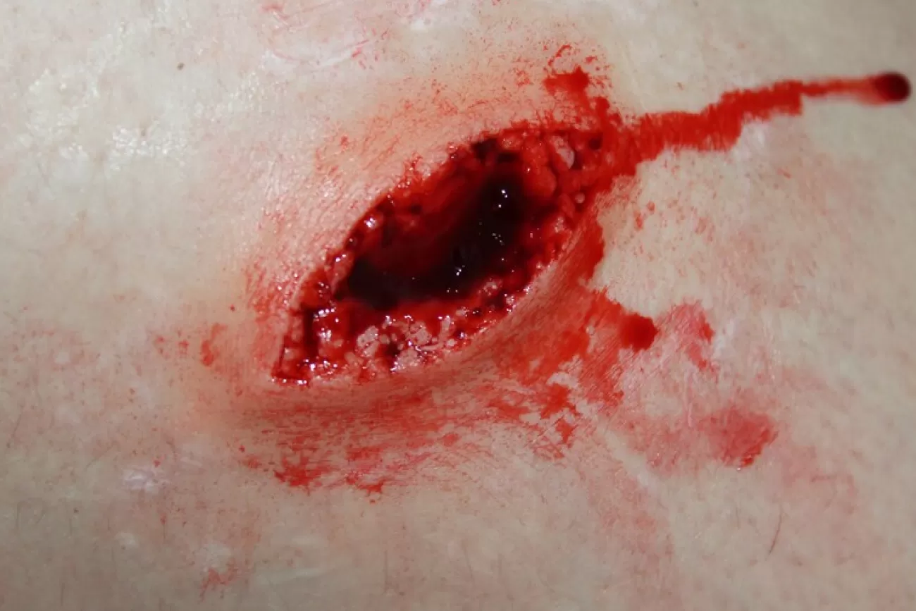 ForensicFX Studios Stab Wound Prosthetic> Halloween Accessories