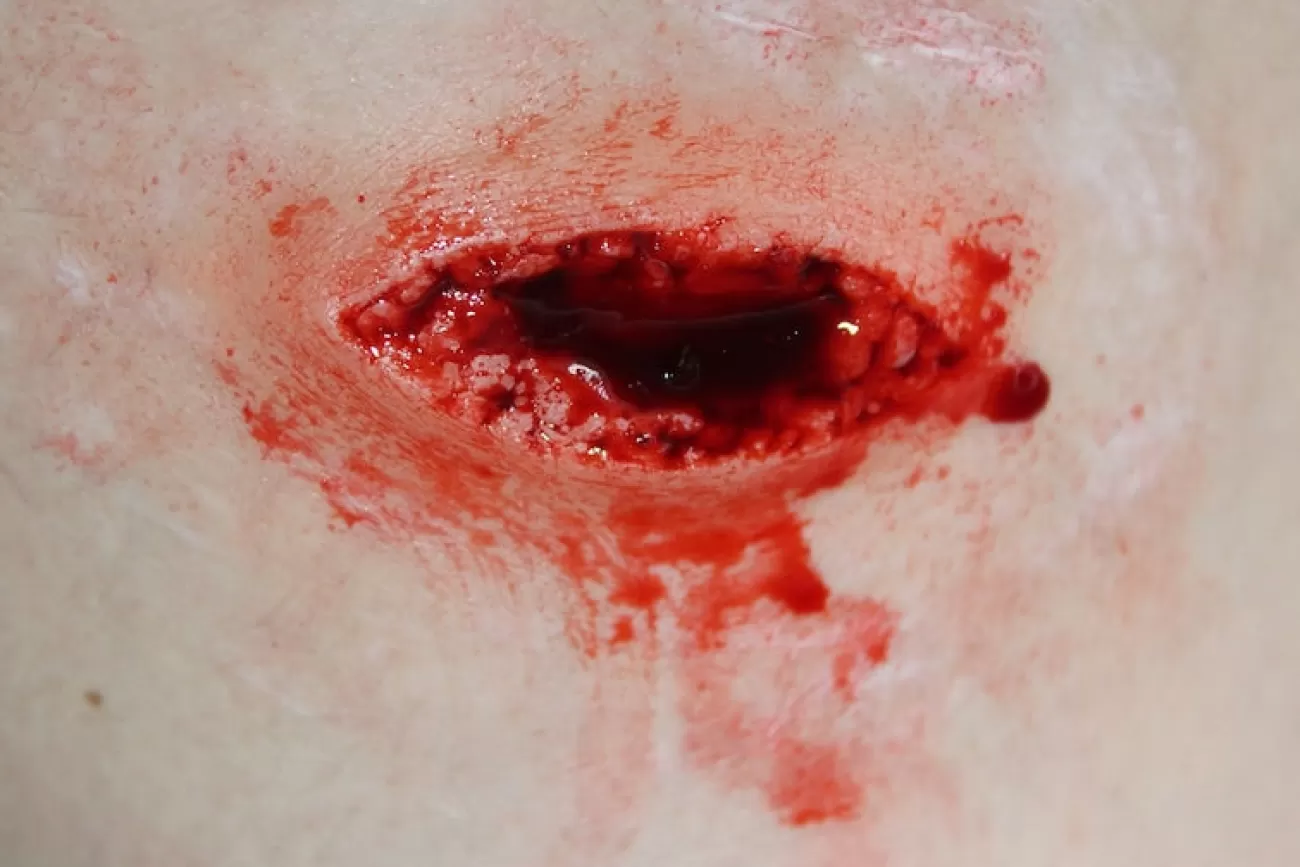 ForensicFX Studios Stab Wound Prosthetic> Halloween Accessories